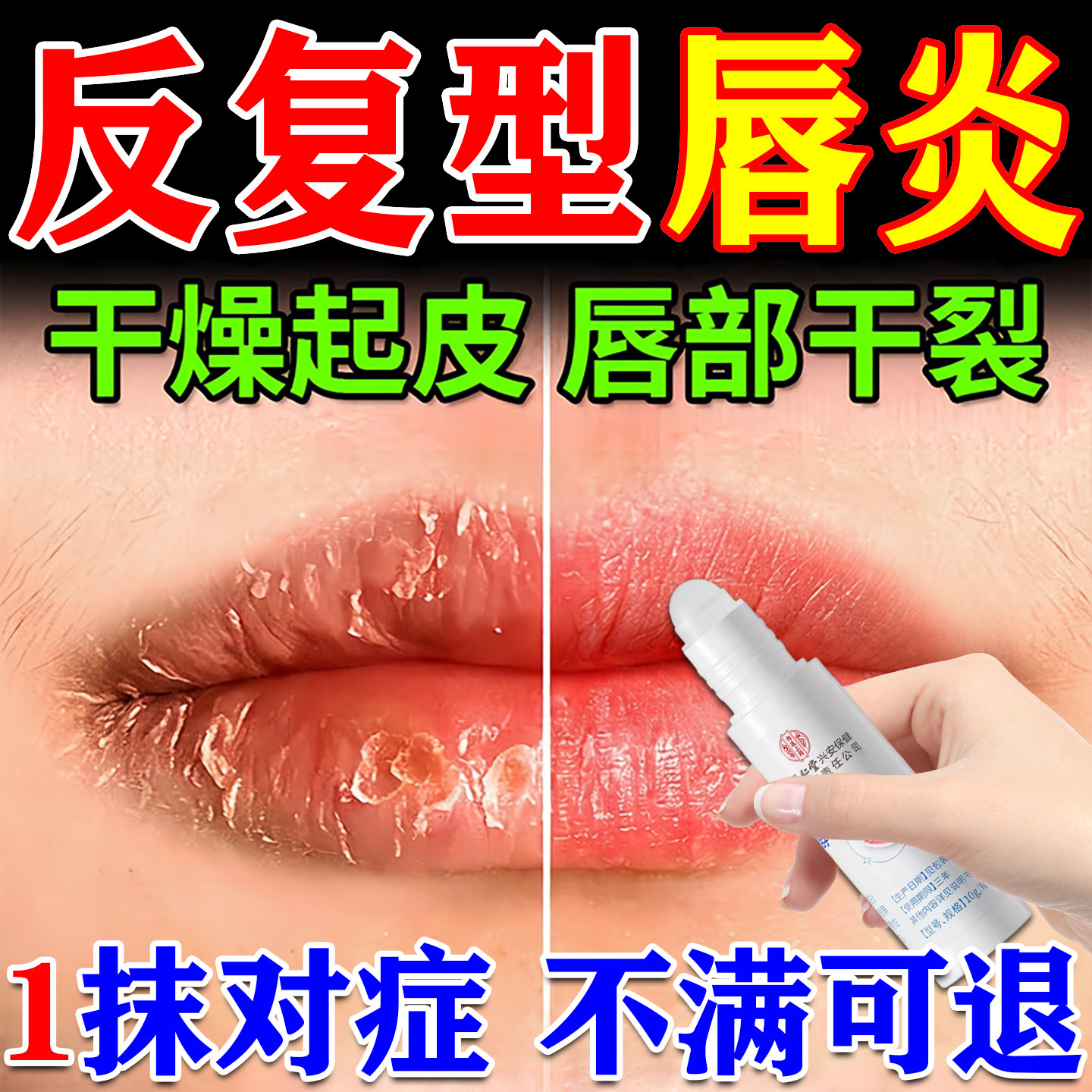唇炎唇膏嘴唇干裂脱皮医用型儿童成人烂嘴角开裂口角炎专用润唇膏