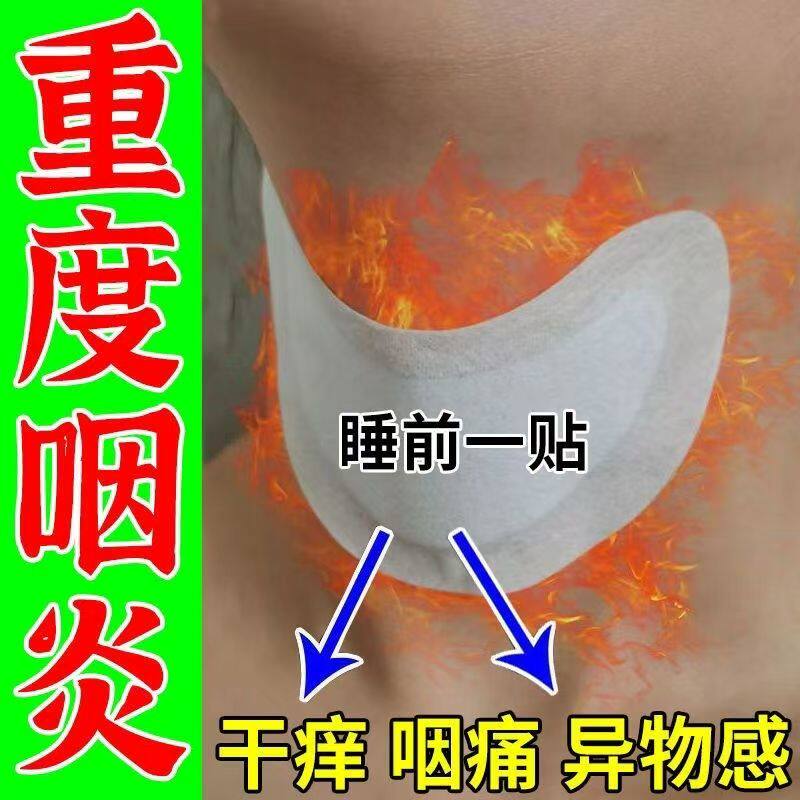 咽炎慢性咽喉炎异物感咳嗽嗓子有痰治疗滤泡增生除i根专用中药贴a