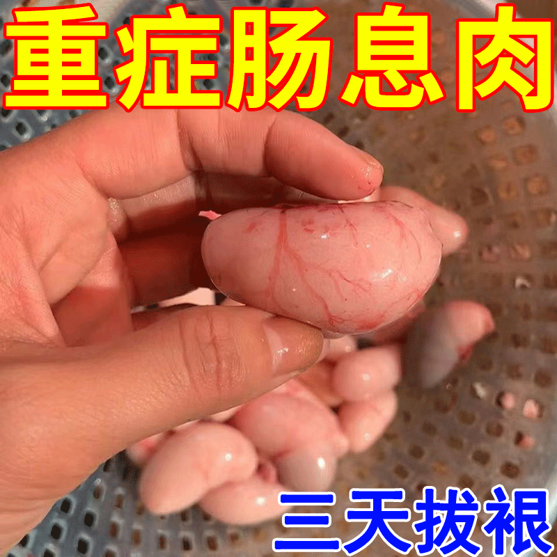 肠息肉去除腺瘤息肉胃痛腹泻大便不成形便血专用HN