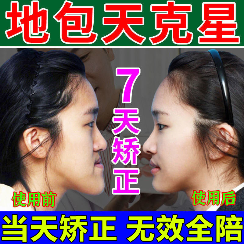 地包天凸嘴下巴后缩牙齿矫正器大人儿童颞颌关节紊乱骨性嘴突龅牙
