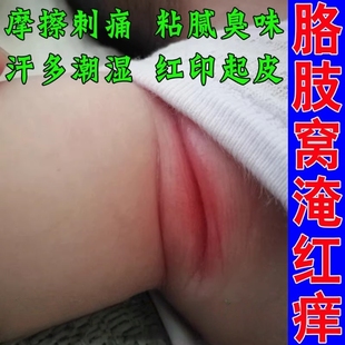 腋下红肿腋下防淹胳肢窝红肿肤痒腋下出汗多异味消红疼痛修复乳膏