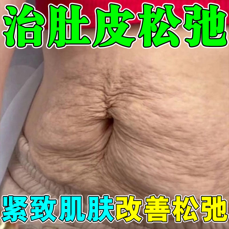 肚子松弛收紧用淡纹膏紧致产后肚皮松弛下垂淡化纹路腹部赘肉修复
