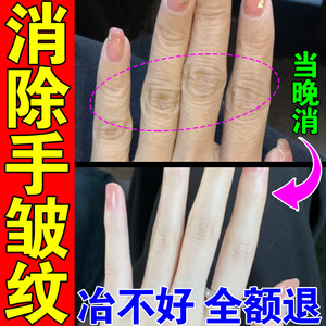 去手指关节皱纹祛除手纹护手霜淡化防干裂粗糙大美白嫩肤修复神器