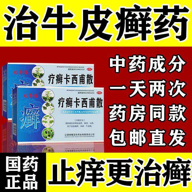 疗癣卡西甫散甫丸普散银屑病非杨绍臣少臣止痒非特效药非进口yka