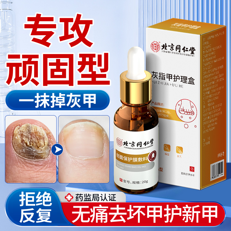 灰指甲抑菌液治疗专用快速脱甲膏非特效水正品旗舰店真菌感染