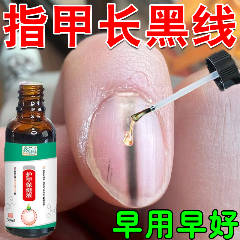 指甲长黑线甲母痣专用护甲保健液