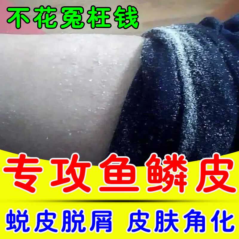 鱼鳞病皮肤霜专用膏去蛇皮肤鱼鳞腿部病皮肤干燥起皮脱屑保湿乳