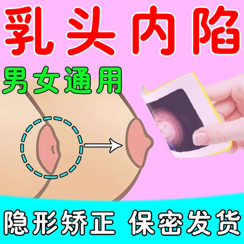 乳头内陷矫正器少女发育不良凹陷