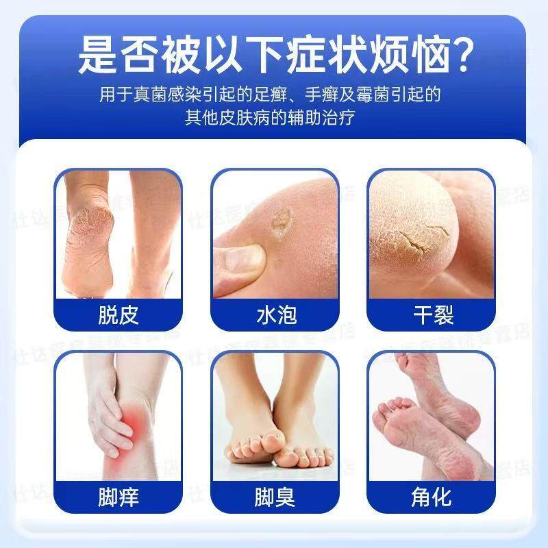 仁和壳聚糖脚轻松喷雾剂脚丫脱皮水泡脚气烂脚痒止痒膏官方正品