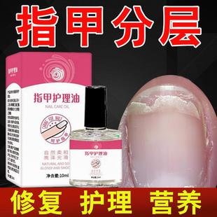 指甲分层变薄脆弱营养油倒刺指甲受损修复液受损再生凹凸不平生长
