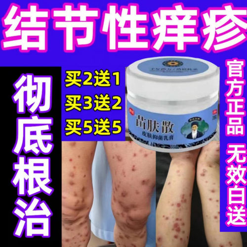 结节性痒疹湿疹皮肤病纯中药膏