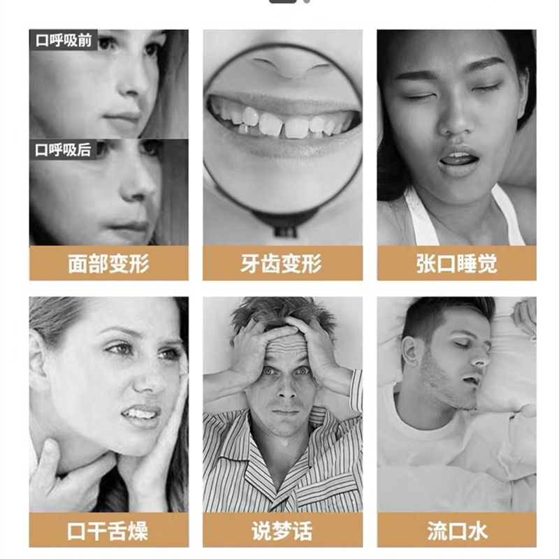 口呼吸矫正器防张嘴睡觉闭嘴神器张口闭口j鼻嘴p巴儿童打呼噜止鼾