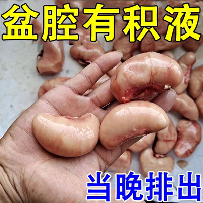 【100%祛根】盆腔积液中药贴输卵- 管堵塞疏通宫腔粘连膏贴腹痛XN