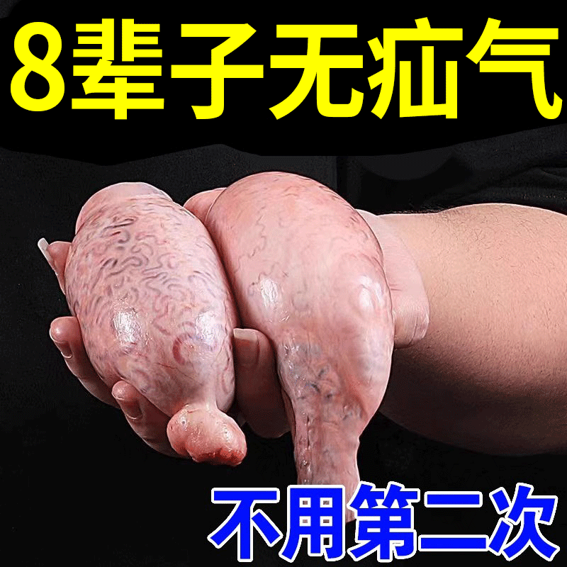 【民间偏方】疝气贴腹股沟鼓包鸡蛋大中老年量子专用疝气带HN