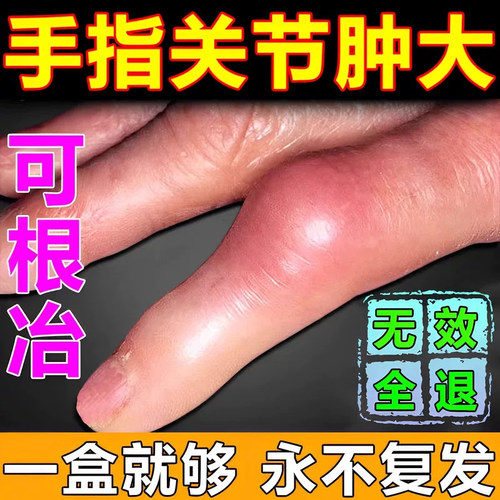 一枝蒿伤湿止痛包邮卫洁祛痛膏片祛风除湿