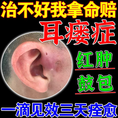 中耳炎美满粒