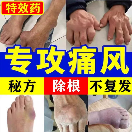 骨刺膏膏买送股骨头贴足跟痛膏贴颈椎腰椎刺痛股骨康坐