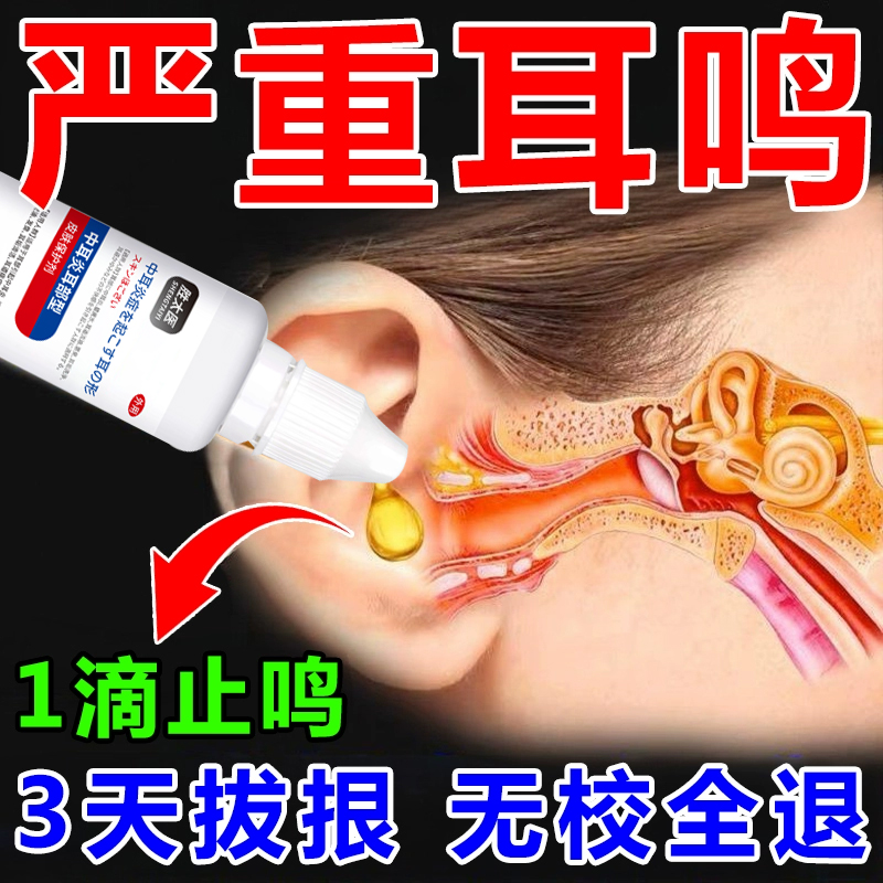 碳酸氢钠滴耳液耳垢清洁剂人用软化耳屎硬去耵聍水洗油儿童宝宝铁
