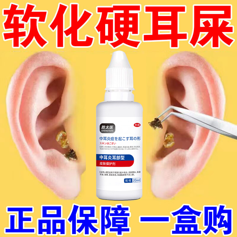 耳朵嗡嗡响滴耳液秒止鸣耳鸣神经性贴耳康贴膏嗡专用药
