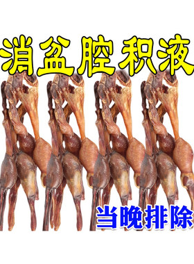 妇科炎症中药贴子宫肌瘤巧克力卵巢囊肿调理月经不调疏