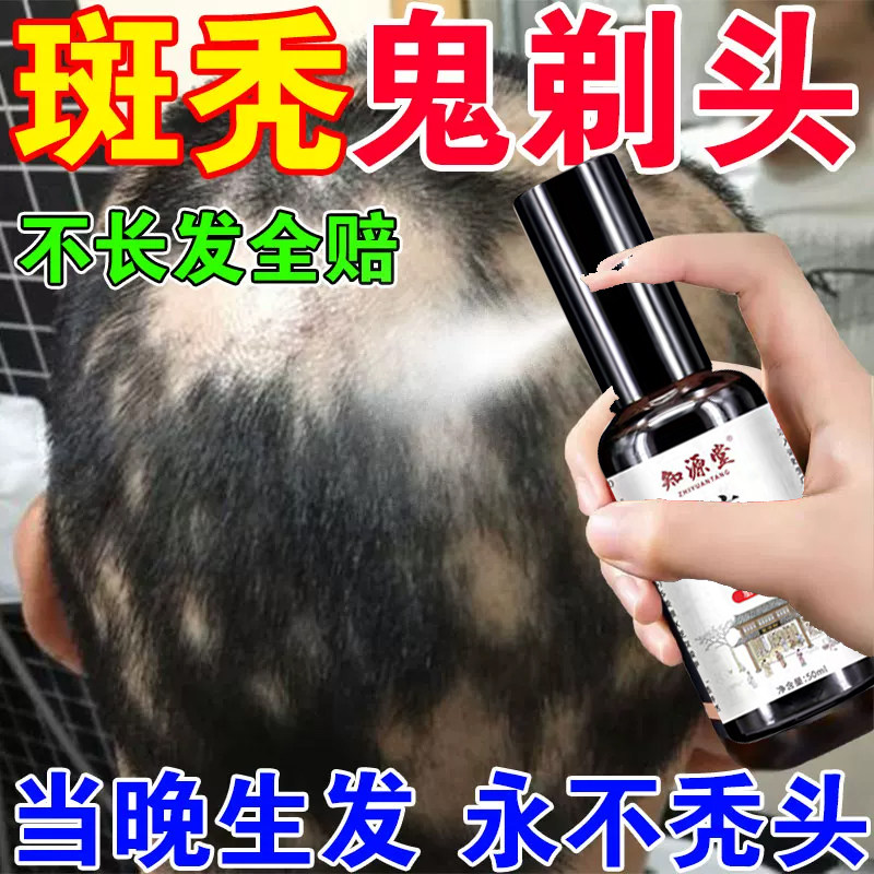 生发丸九芝堂乌须黑发早白脱发治白发固肾生发丸生发图片