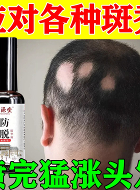 复方甘草酸苷片帅能gd复发方甘草片苷酸酐片非宠物用100