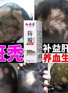 益肾乌发丸宝发口服液百派非乌发精华液二至丸黑发ZZ