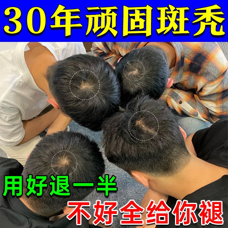益肾乌发百派益肾乌发口服液头发早白发补肾脱落脱发肝肾阴虚图片