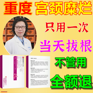 宫颈糜烂贴纳氏囊肿修复肥大息肉纳囊用吃的可搭膏药治疗仪NK