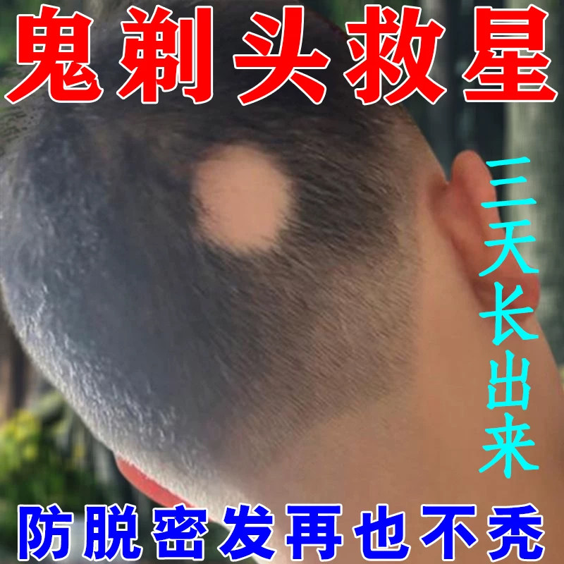 天麻首乌片 200 片国华白发治疗脱发生发滋阴补肾脂溢性脱发图片