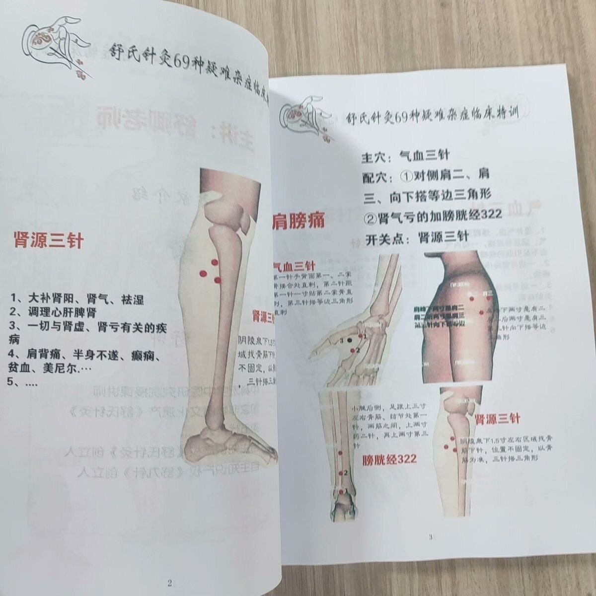 记事本舒氏针灸69种疑难杂症临其它印刷制品