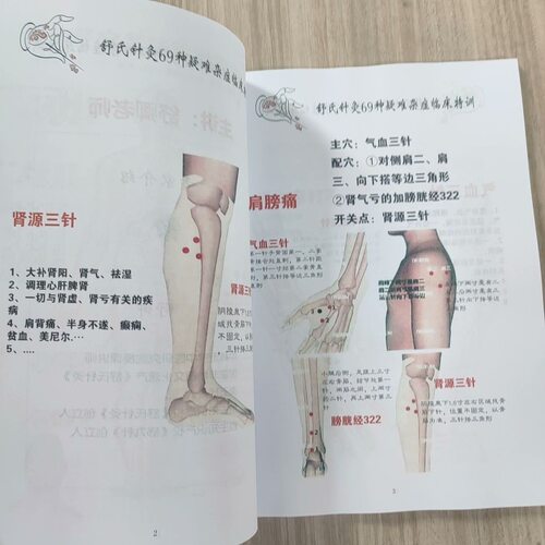 记事本舒氏针灸69种疑难杂症临床特训升级版大开本笔记本资料
