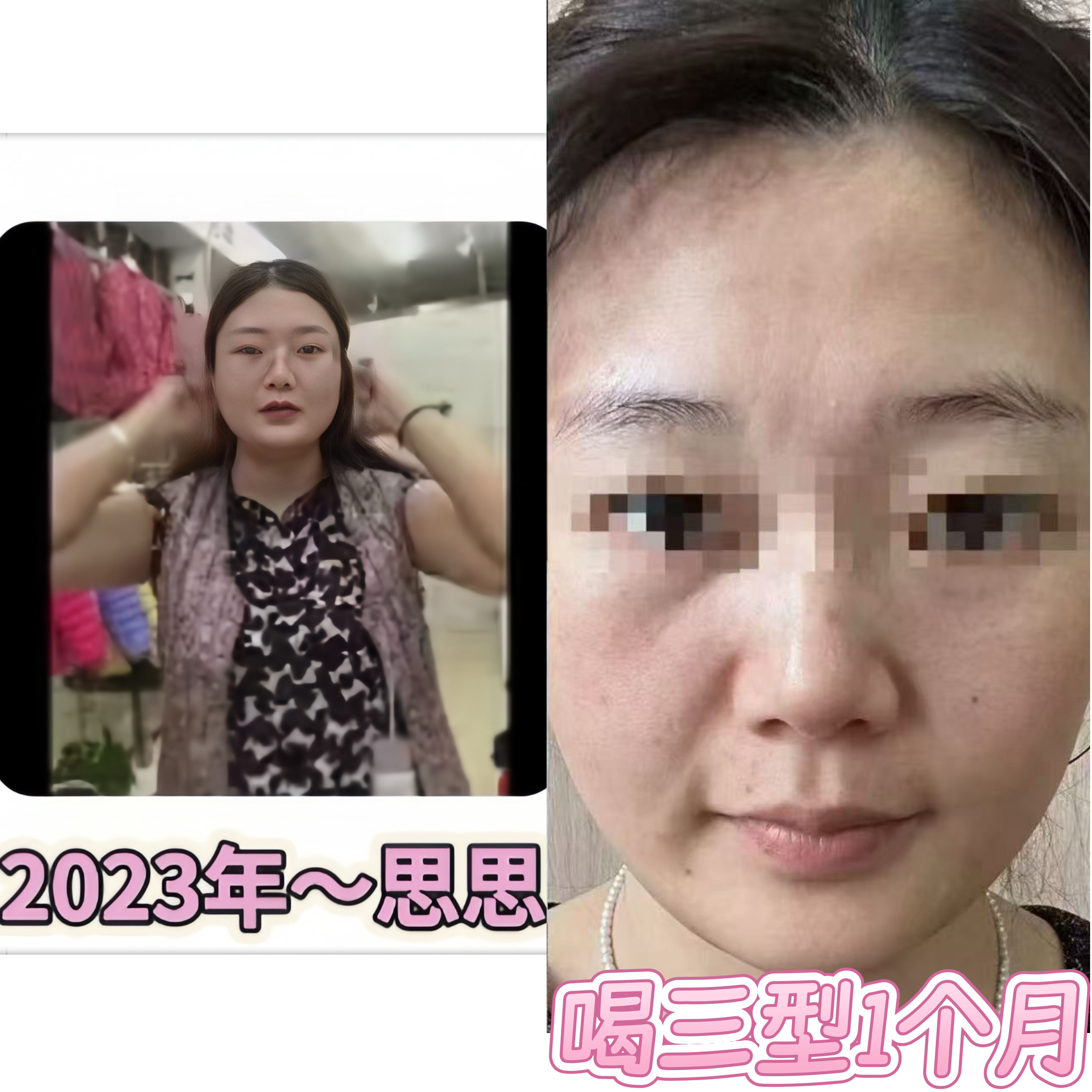 【SS专享】口服Y美III型胶原 反馈!!!