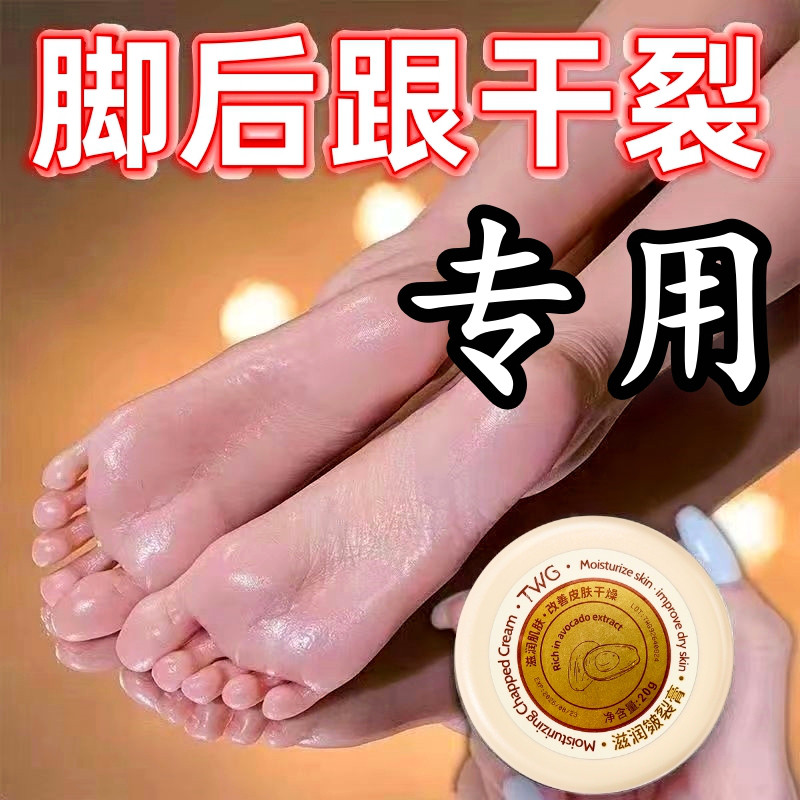 破裂膏脚后跟干裂霜龟裂手脱皮起皮皴裂膏脚裂滋润保湿护手霜通用,美容护肤/美体/精油,护手霜,淘宝优惠券,粉丝福利购,淘宝优惠卷