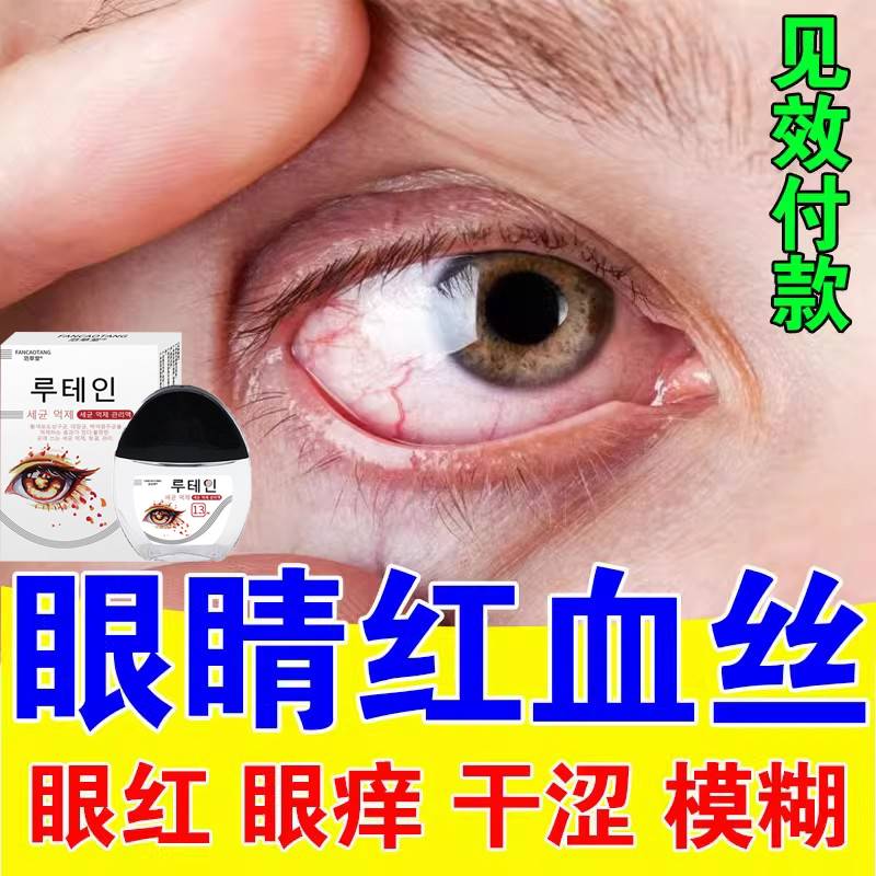 叶黄素滴眼液缓解疲劳干涩视线模糊红血丝迎风流泪护眼润眼滴眼水