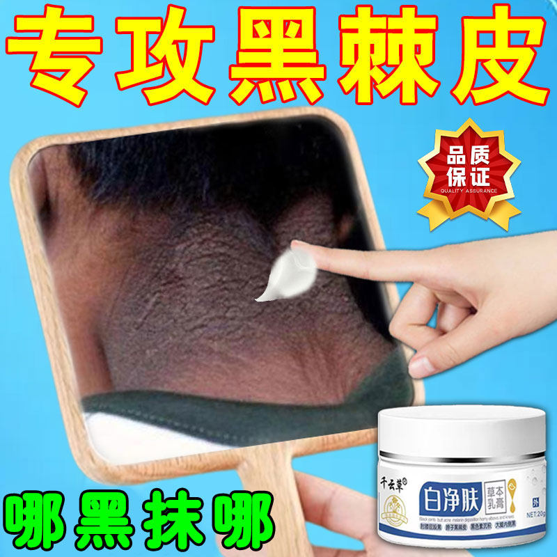 脖子黑棘皮外用膏全身适用