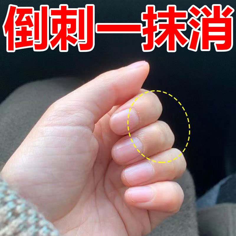手指倒刺修复儿童指甲指缘油去倒刺油手上长手起倒刺防倒刺营养油