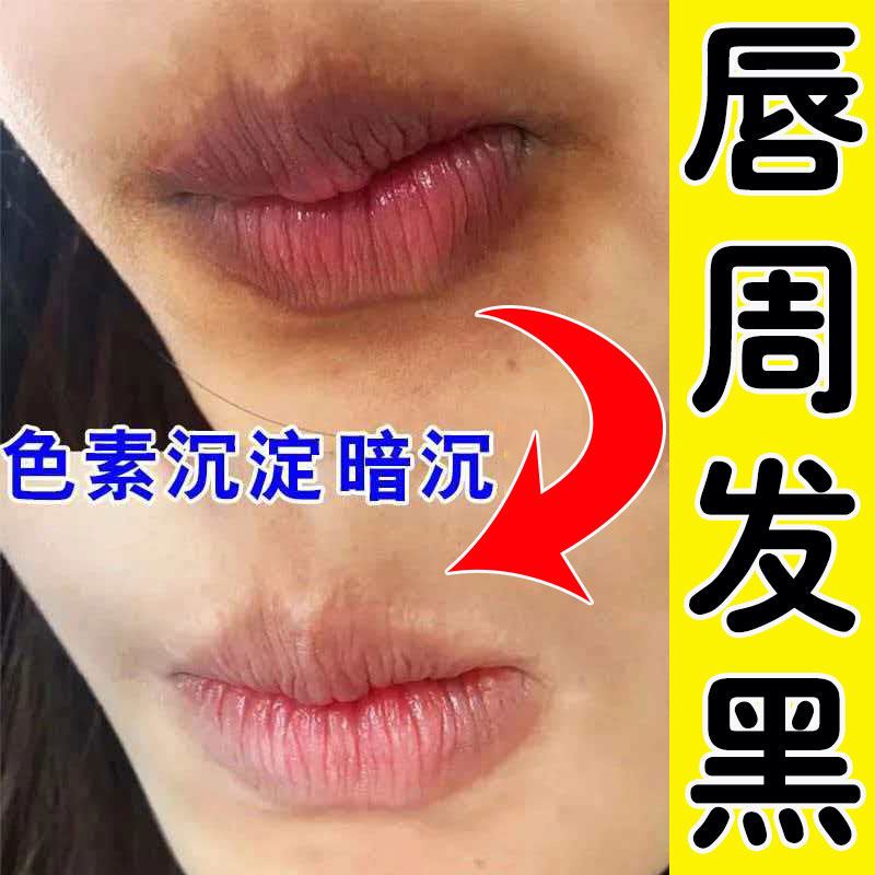 唇周发黑去除改善唇周黑嘴唇黑色素沉淀去除嘴角暗沉嘴巴周边死皮