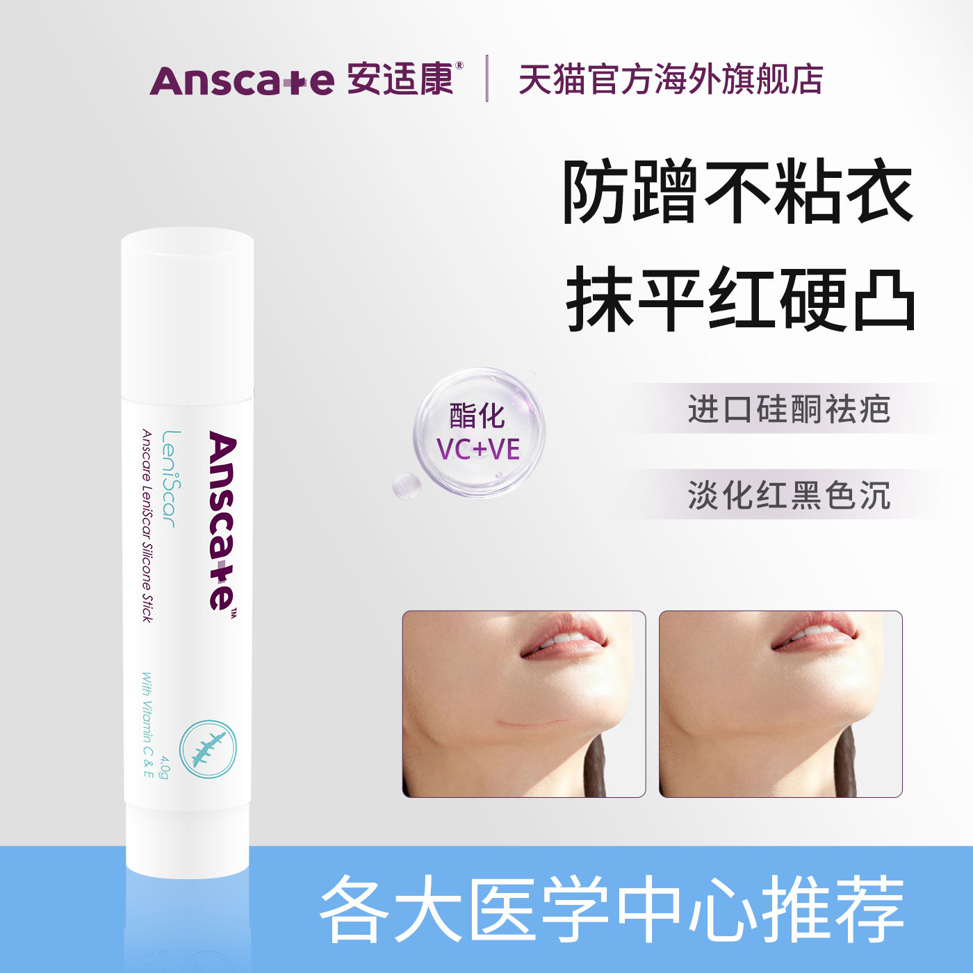 安适康祛疤膏去疤痕去黑色素增生疤痕修复除疤膏