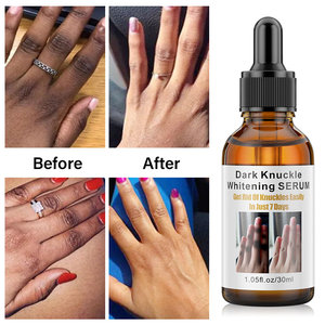 Dark Knuckles Fast Whitening Serum Pigmentation Correctors f