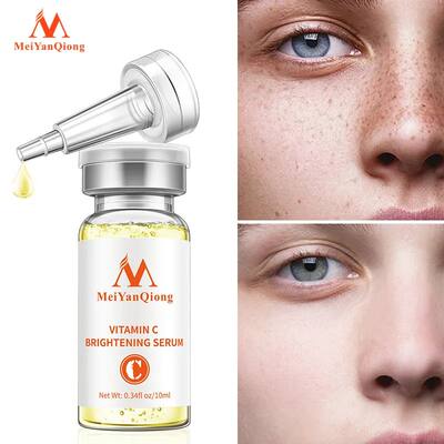 Vitamin C Brightening Serum Moisturize Repair Tender And Tra