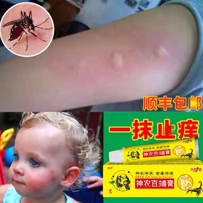 蚊虫叮咬跳蚤咬止消红痒药膏液臭虫蚊子咬儿童成人皮肤过敏外用肿