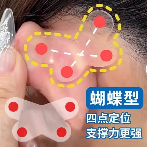 听谷精灵耳贴蝴蝶型强支撑不痛