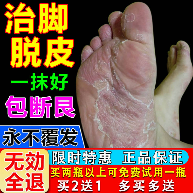 脚脱皮脚后跟粗糙起硬皮修复霜