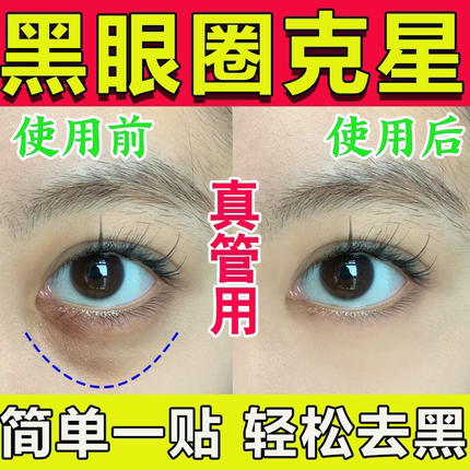 黑眼圈去除神器男士特别严重眼膜淡化细纹抗衰强力除祛眼袋贴克星