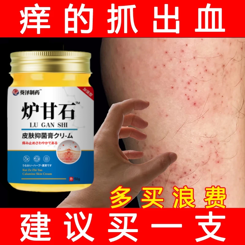 治腿痒小腿皮肤干燥瘙痒起小红点疙瘩春夏天热止痒抑菌膏药炉甘石