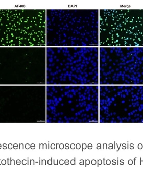 Elabscience®一步法TUNEL原位细胞凋亡检测试剂盒（绿色 AF488）