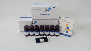 Elabscience®酸性磷酸酶(ACP)比色法测试盒E-BC-K094-S 50assays