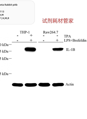 Anti-IL-1 beta Rabbit pAb,抗IL-1beta兔pAb,GB11113-100,100μL