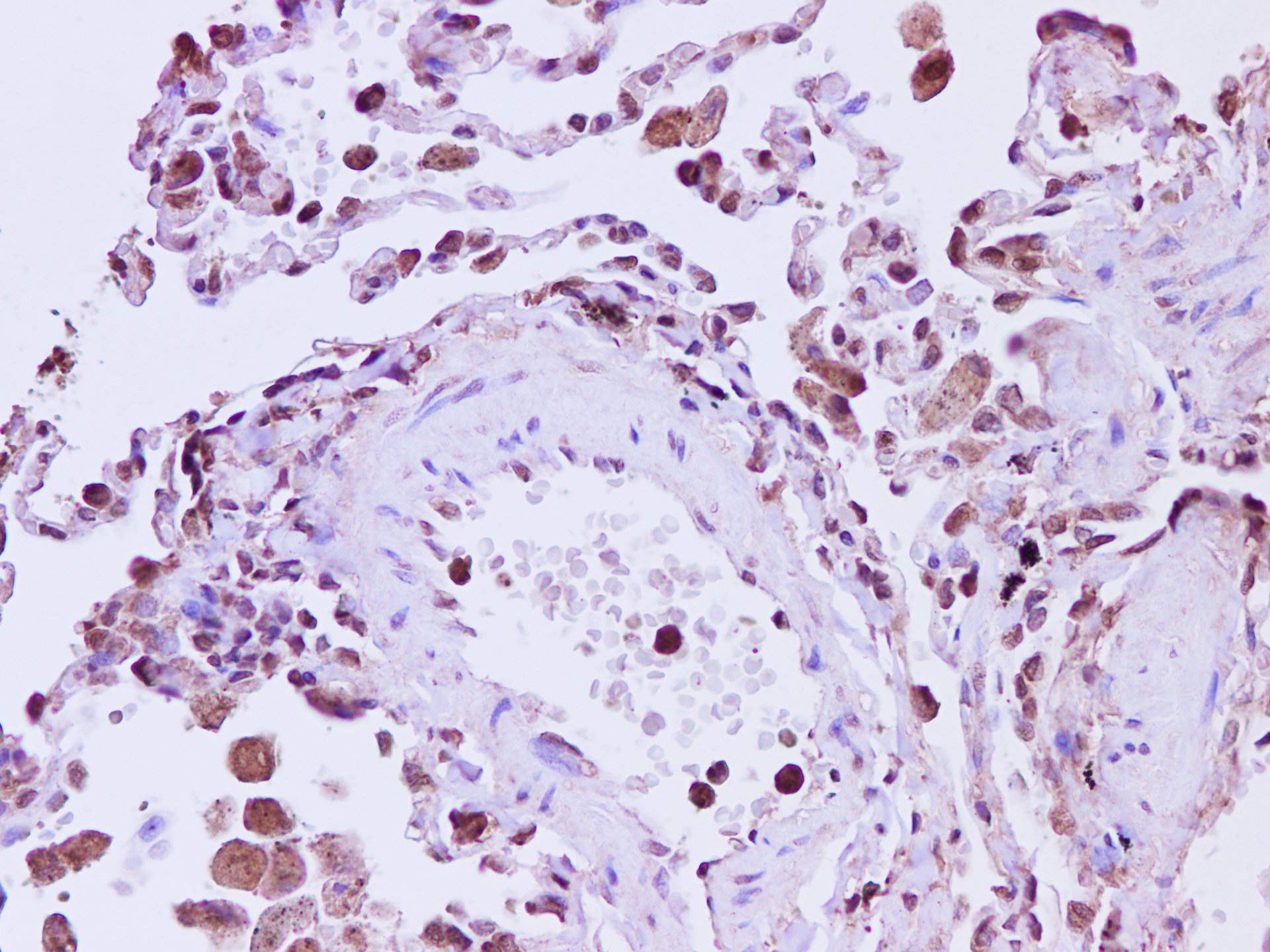 Elabscience® ANXA5多克隆抗体 E-AB-40249 适用免疫组化 200μL